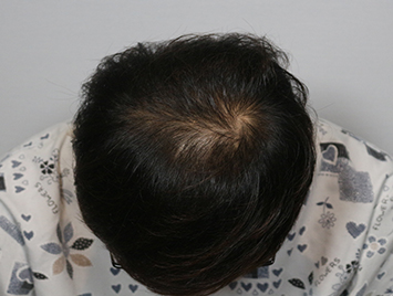 Before case 05