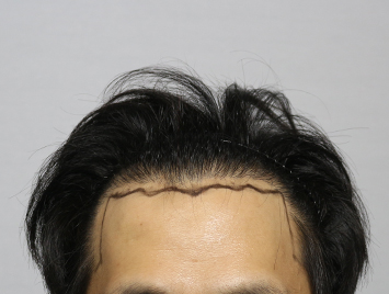 Before case 06